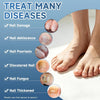 Nail Fungus Treatment (Pack Of 5)
