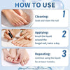 Nail Fungus Treatment (Pack Of 5)
