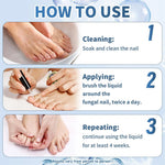 Nail Fungus Treatment (Pack Of 5)